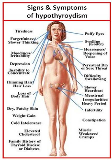 underactiveThy.jpg